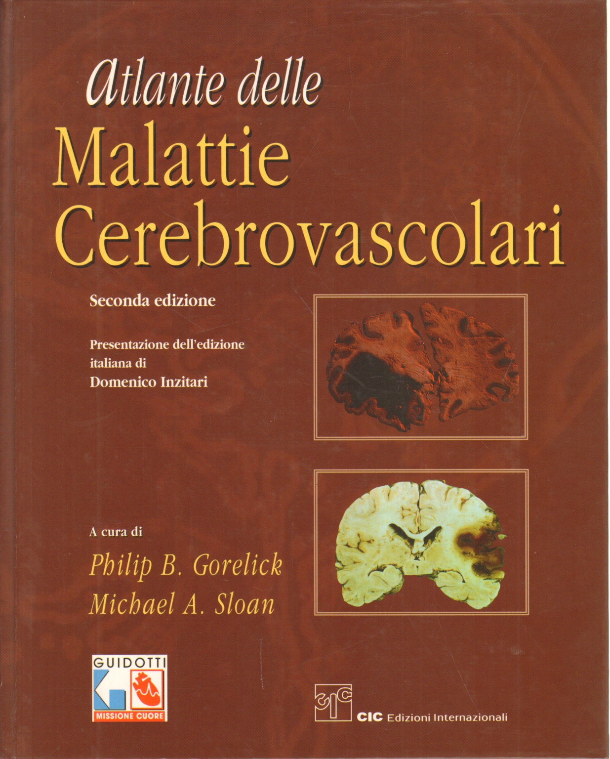 Atlas der krankheiten zerebrovaskuläre erkrankungen, Philip B. Gorelick, Michael A. Sloan